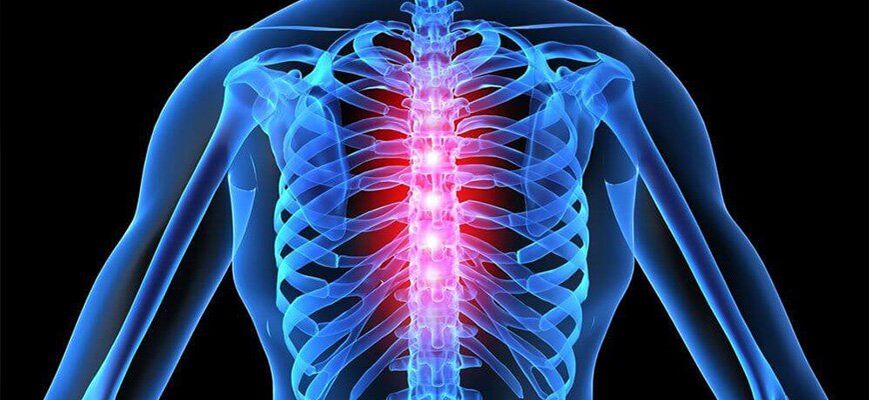 Acute pijn is kenmerkend voor exacerbatie van osteochondrose van de thoracale wervelkolom