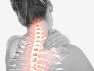 Osteochondrose van het cervicale gebied