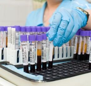 bloedonderzoek om gewrichtspijn te diagnosticeren