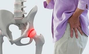 oorzaken van artrose van het heupgewricht