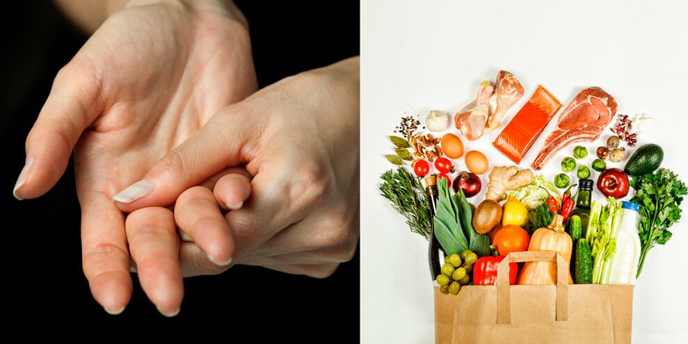 jichtartritis van de handen en voedsel voor de behandeling ervan