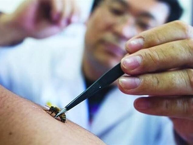 apitherapie voor cervicale osteochondrose